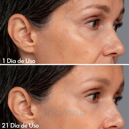 Massageador Facial com Fototerapia Anti-Rugas DermaLift
