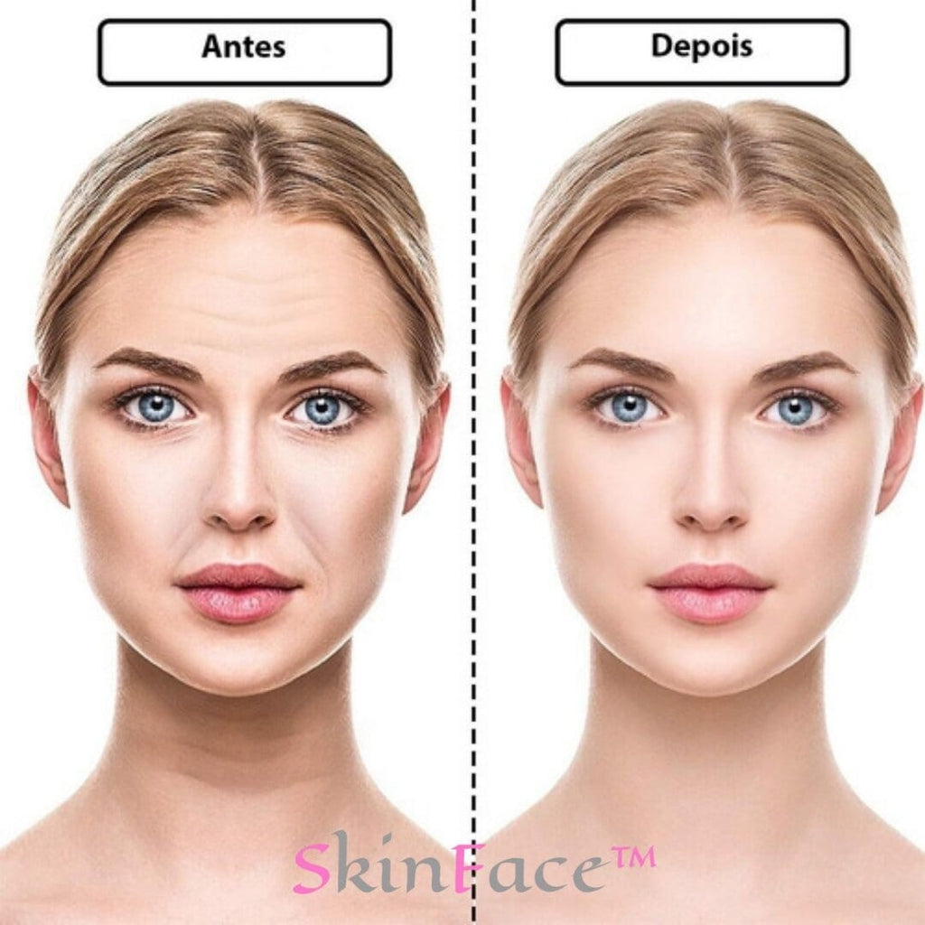 SkinFace™ - Adesivos de Silicone Rejuvenescedor Anti Rugas - True Inovare