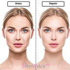 SkinFace™ - Adesivos de Silicone Rejuvenescedor Anti Rugas - True Inovare