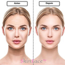 SkinFace™ - Adesivos de Silicone Rejuvenescedor Anti Rugas - True Inovare
