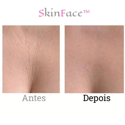 SkinFace™ - Adesivos de Silicone Rejuvenescedor Anti Rugas - True Inovare