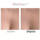 SkinFace™ - Adesivos de Silicone Rejuvenescedor Anti Rugas - True Inovare